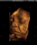 Nicolay Enrico Narvaez Restrepo